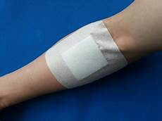 Sterile Wound Dressings